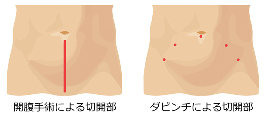 体への負担が少ない